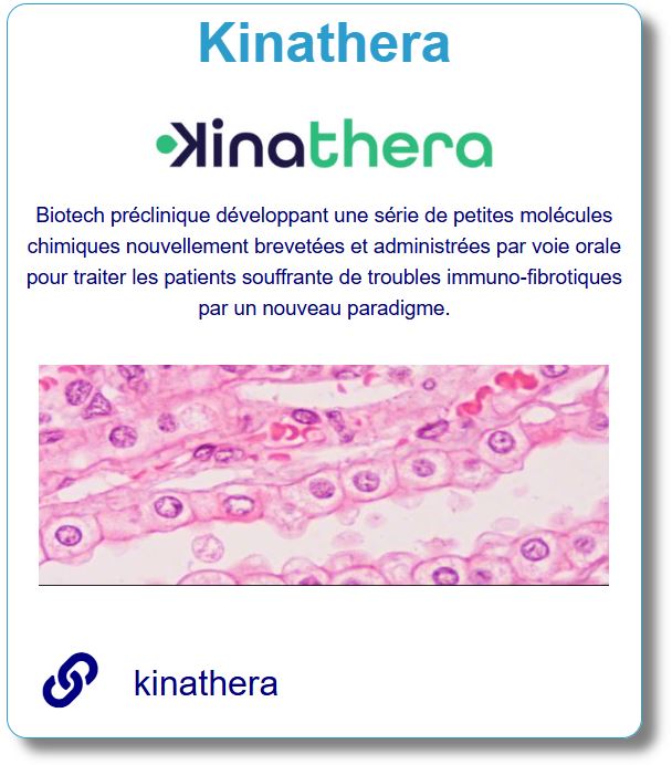 kinathera